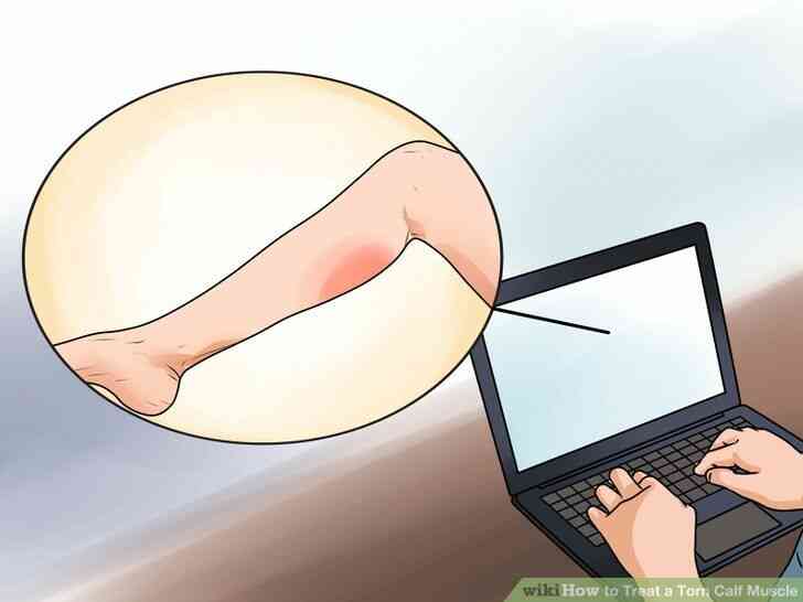 Image intitulée Soigner une déchirure Musculaire du Mollet Étape 3